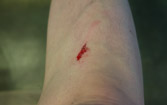 Ouch!  I hate doing this.